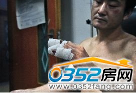伤者徐某,他左手3根手指被胶布缠住